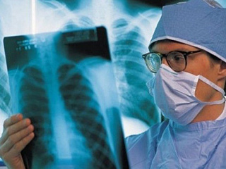 Горздравотдел обращает внимание горожан на проблему туберкулеза