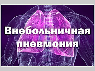 Более 60 случаев внебольничной пневмонии зарегистрировано в Горно-Алтайске
